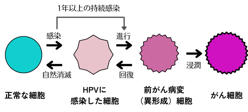 子宮頸がん発生のメカニズム